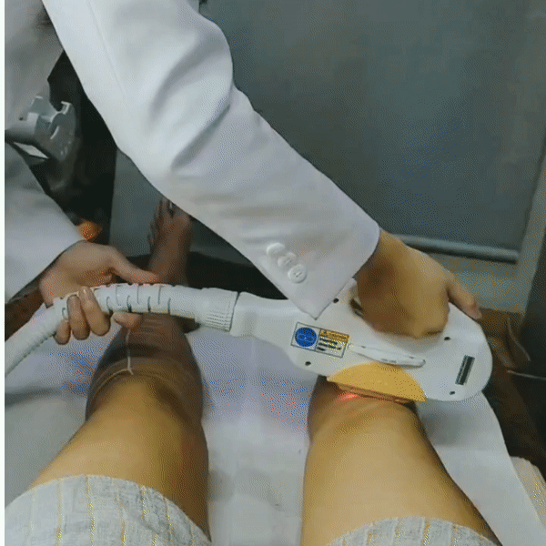 erhair removeasy hair removal by ipl - legs area