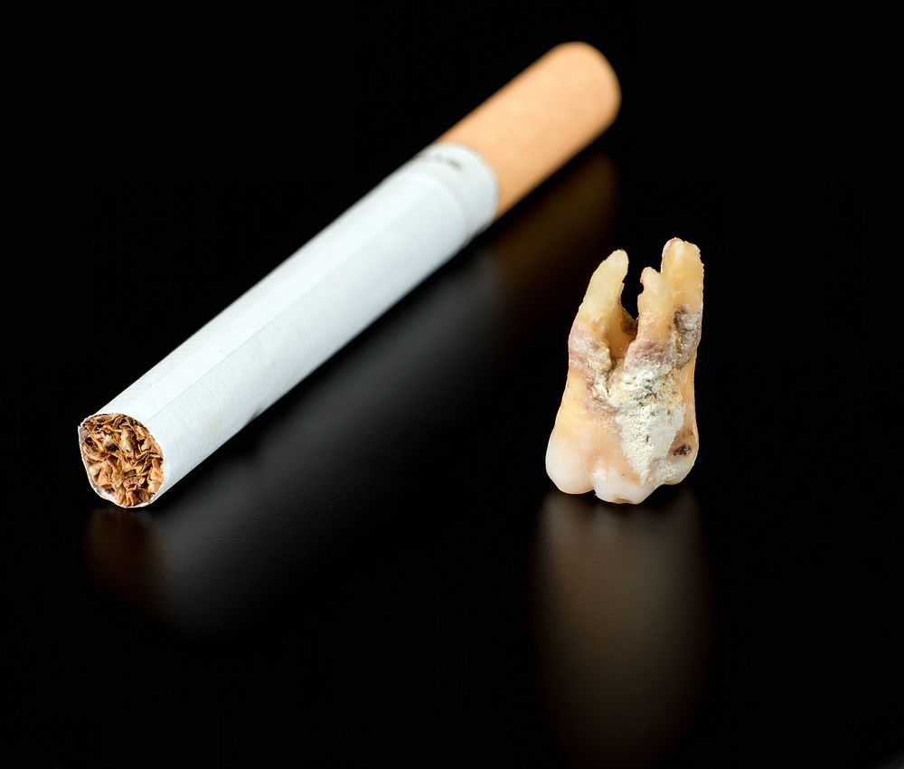 TobaccoAssociated Lesions of the Oral Cavity Part II. Malignant Lesions