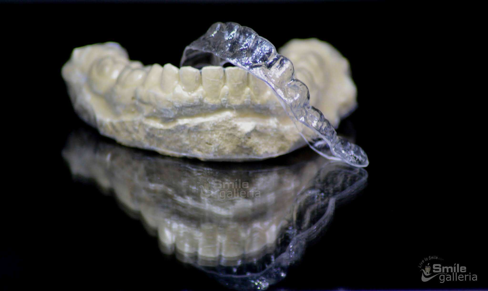 Smile Galleria Night Guard Instructions How to Care for it Smile