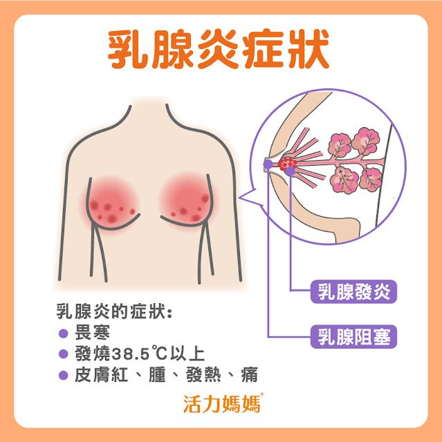 乳腺炎症狀