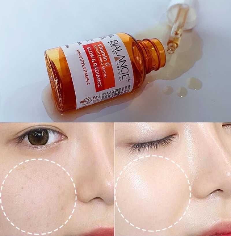Serum trắng da, mờ thâm Balance Active Formula Vitamin C Brightening 30ml Serum trắng da, mờ thâm Balance Active Formula Vitamin C Brightening 30ml