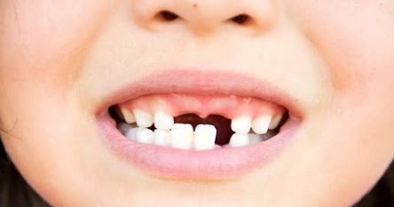 88 Arti Mimpi Gigi Atas Copot Sebagian Semua Menurut Islam Dan Primbon Jawa Pertanda Mimpi Gigi