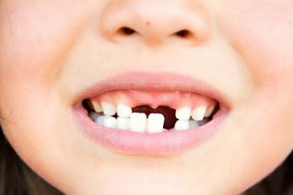10 Arti Mimpi Gigi Copot Geraham Bawah Taring Bagian Atas
