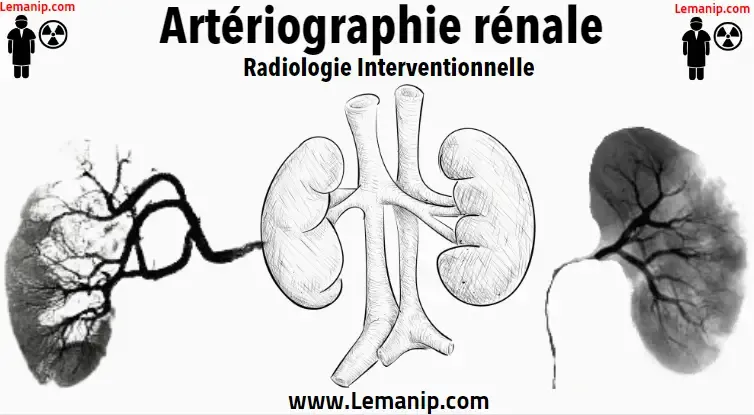 Artériographie rénale Radiologie