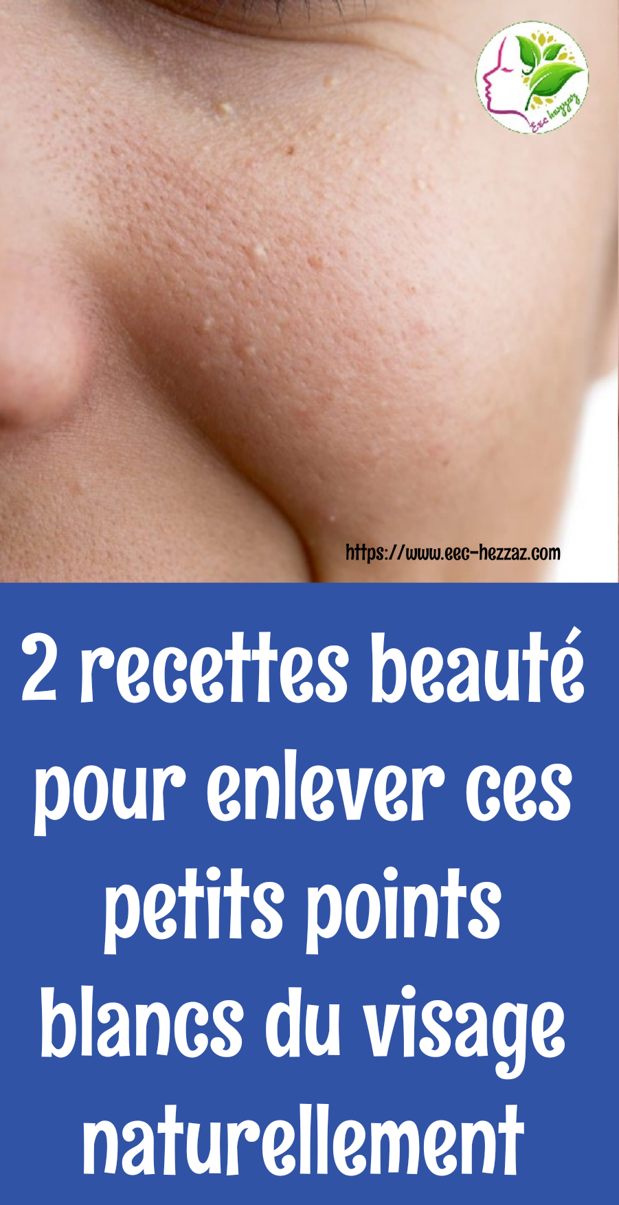 2 recettes beauté pour enlever ces petits points blancs du visage naturellement