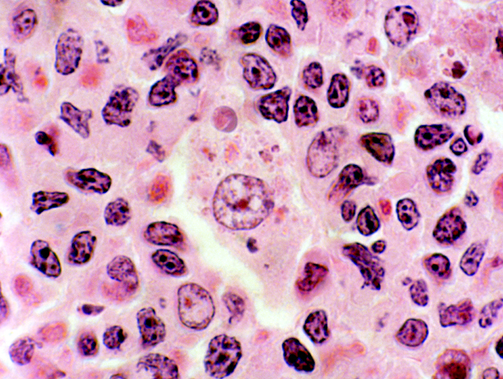 Макрофаги в тканях. Макрофаг гистиоцит гистология. Макрофаг гистология препарат. Лейкоциты, гистиоциты, макрофаги.
