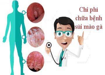 Chi phí trị bệnh sùi hết bao nhiêu tiền vậy? Có mắc không?