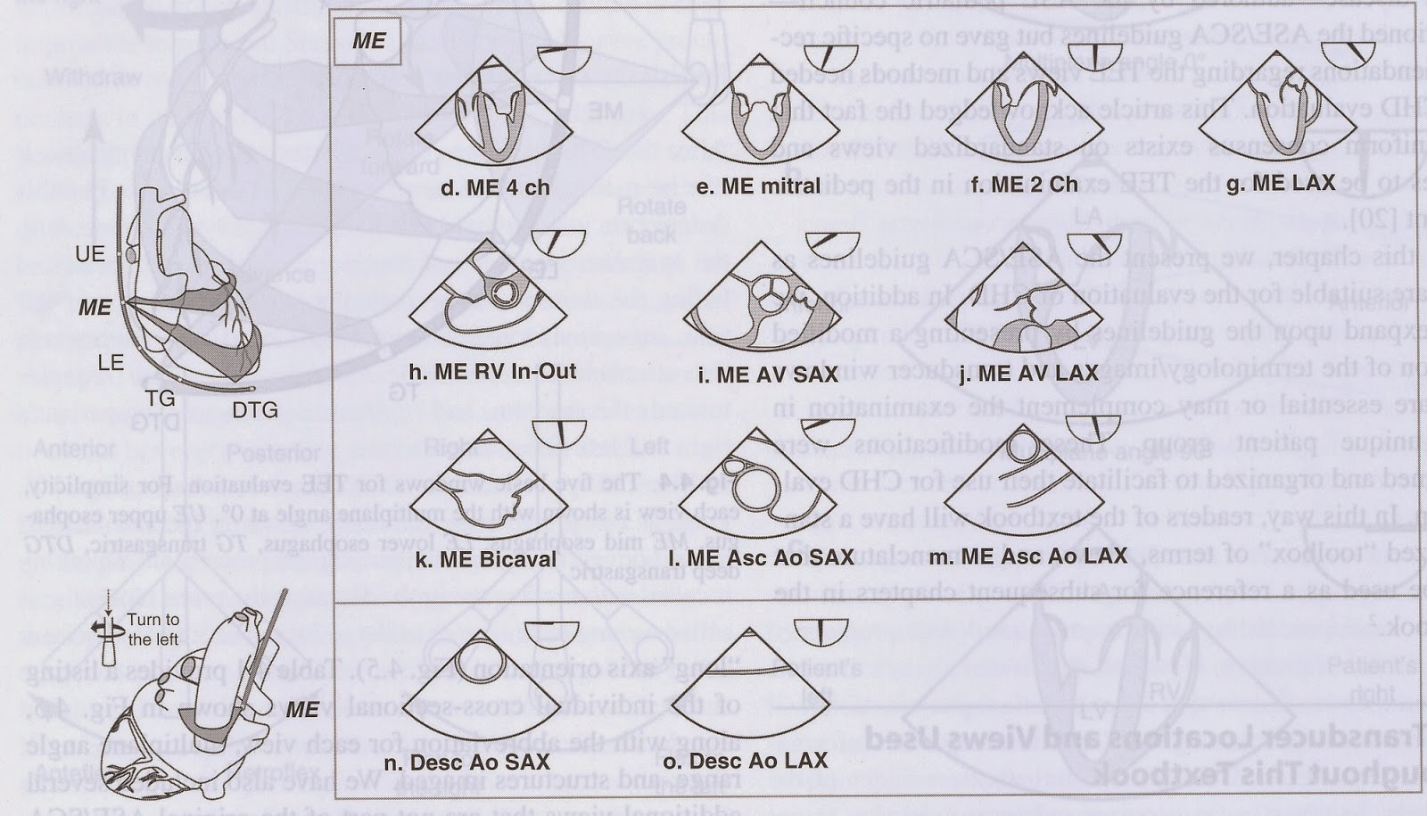 Pedi cardiology TEE Basic Views & terminology