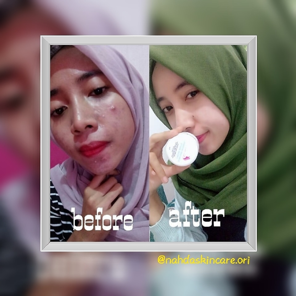 Apa Manfaat Nahda Skincare? - BISNIS MODAL KECIL UNTUNG BESAR AGEN