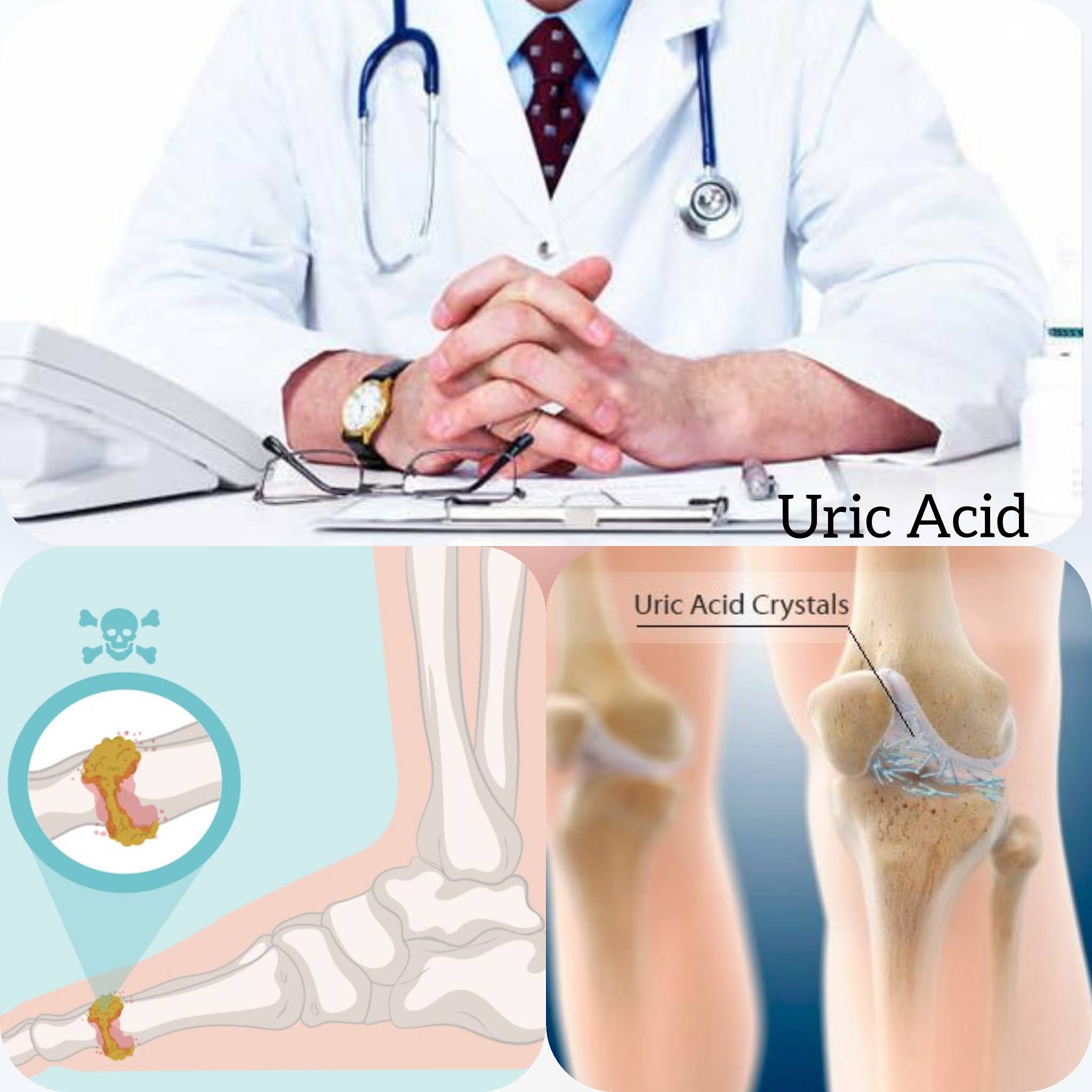 Which Food Is Best For Uric Acid And How To Cure