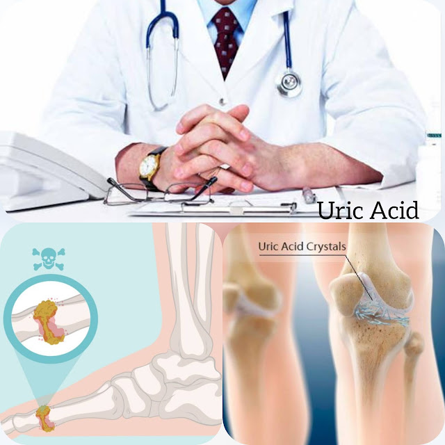 Which Food Is Best For Uric Acid And How To Cure
