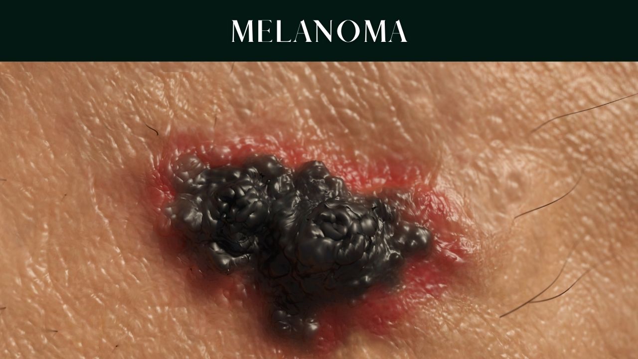 skin-cancer-types- causes-symptoms-pictures skin-cancer-types- causes-symptoms-pictures