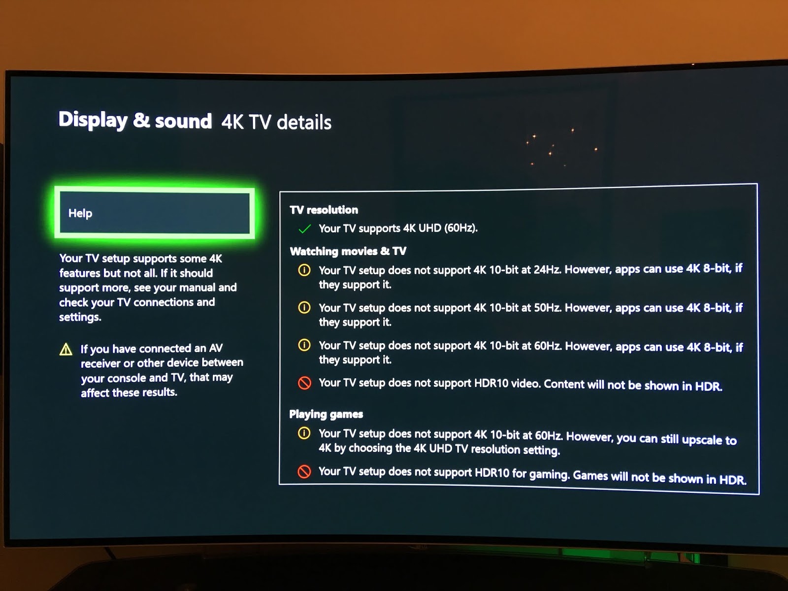 Voorkomen benzine Armoedig How to Fix the Video's Quality Issues on Xbox One? - Evelyn Georgia