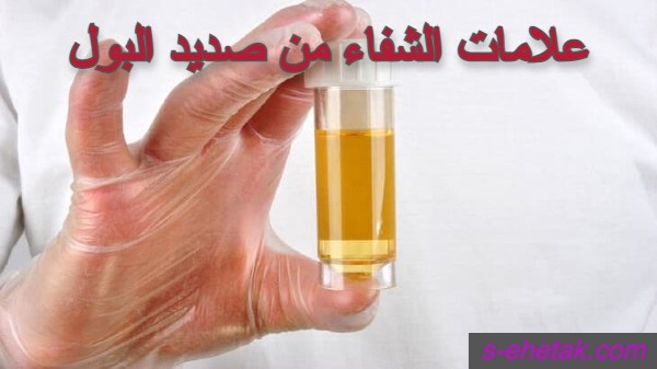 علامات الشفاء من صديد البول