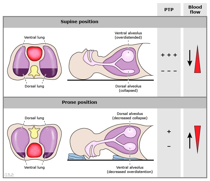 MEDICINA INTENSIVA CUSTOMIZADA