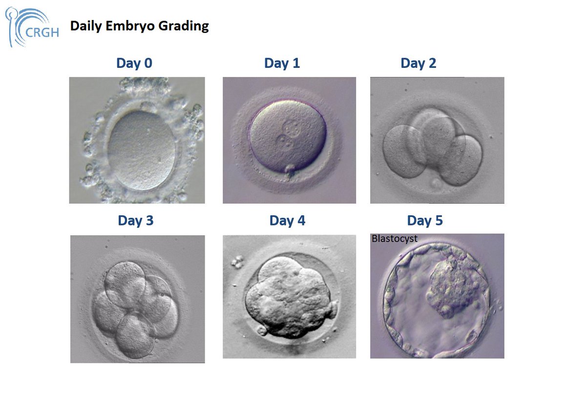 How sequential embryo transfers reduce IVF pregnancy rates