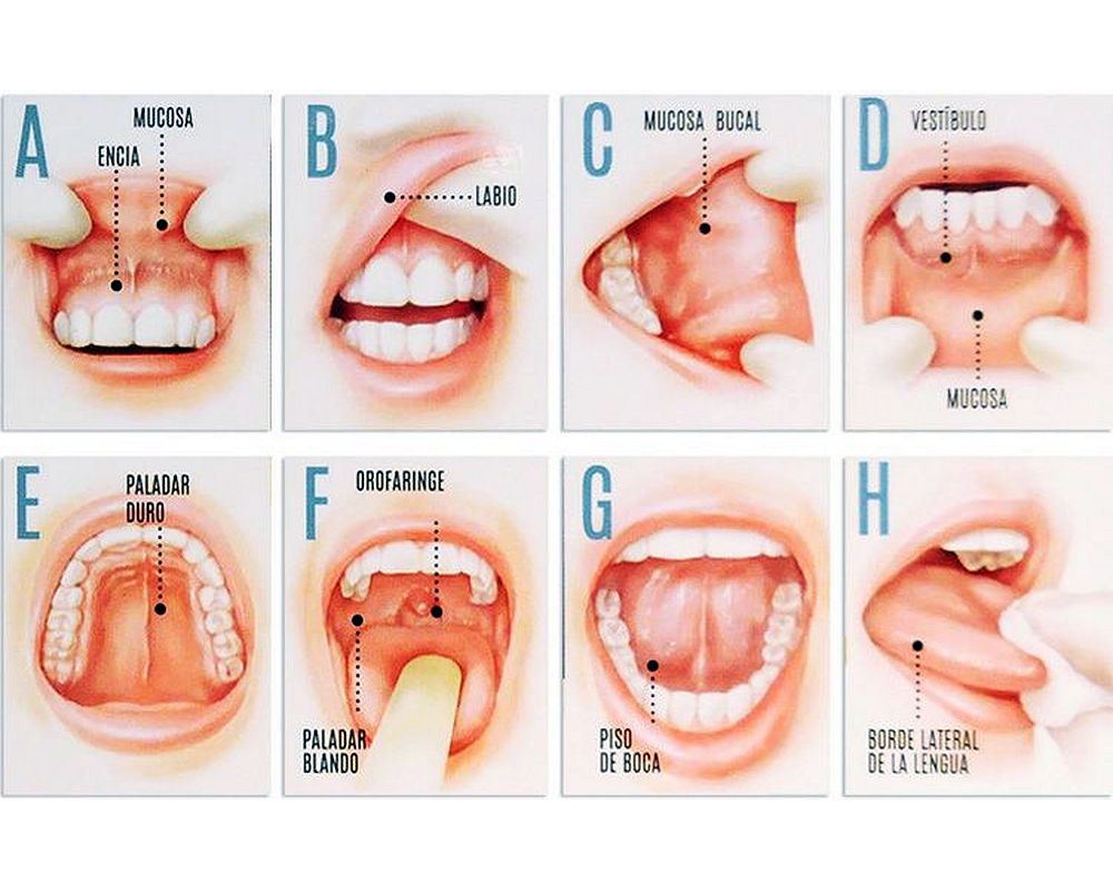 Hpv virus symptoms male, Cancer bucal articulos cientificos