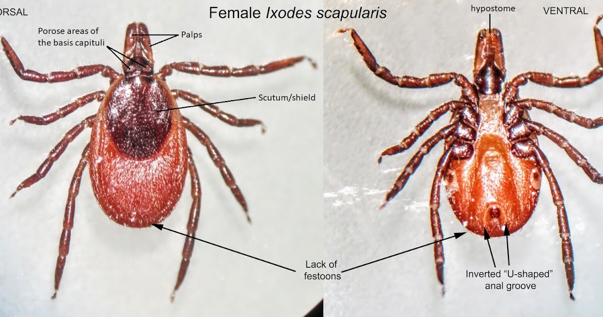 Creepy Dreadful Wonderful Parasites Answer to Case 585