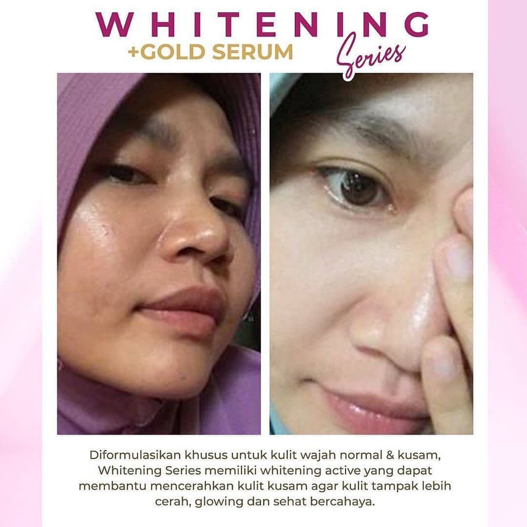 testimoni ms glow skin care