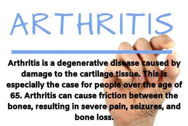 Do You Suffer From Arthritis Do These Exercises Every Day
