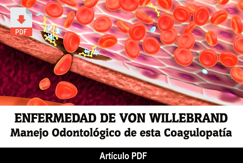 PDF ENFERMEDAD de VON WILLEBRAND Manejo