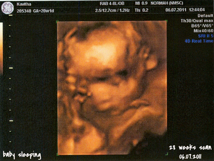 Ruthies's Journal 28 Weeks 2D & 3D/4D Ultrasound Scan Photos