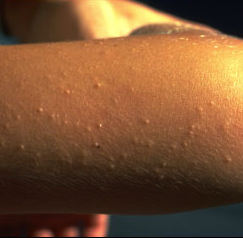 Asthma heilen und mit Allergien und Histaminintoleranz besser leben ...