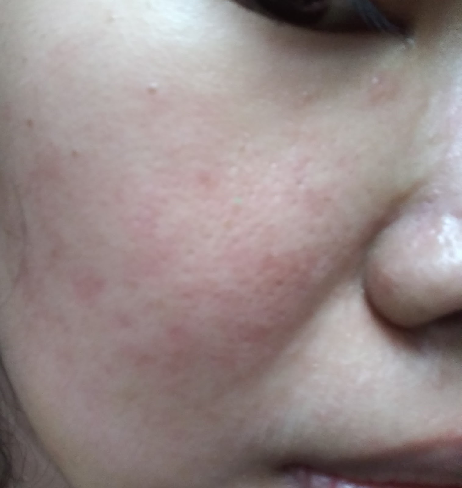 Estetika Dr Affandi Review