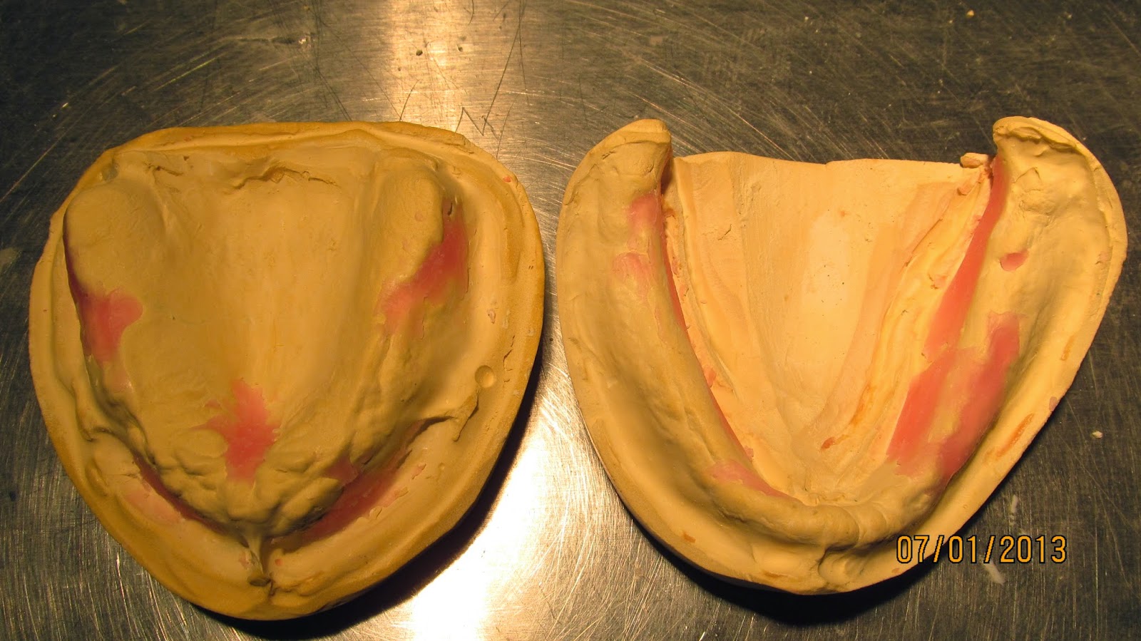 Dental Clinical Case Presentations StepbyStep guides Complete