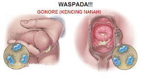 Berapa Harga Obat Kencing Nanah Gangjie Ghosiah Di Bengkulu
