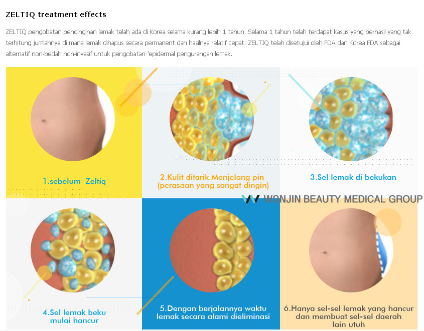 сталовые клетки в жировой ткани. вода в жировых клетках. жир под микроскопом. жировые клетки адипоциты. жировая ткань под микроскопом.