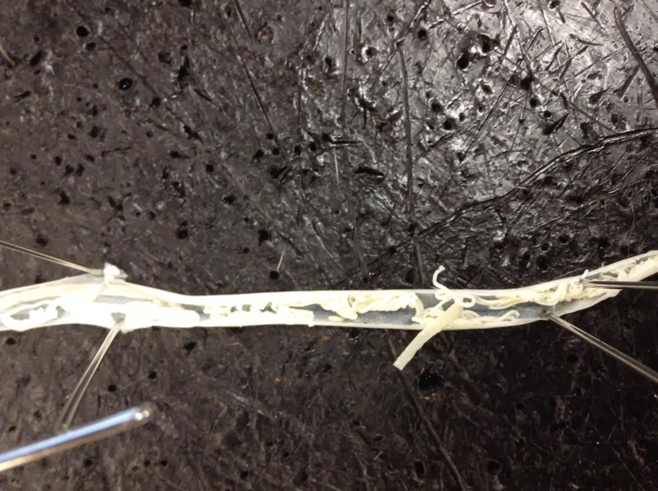 Set The House Spider Free: Round Worm Dissection