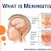 Meningitis – All You Need To Know