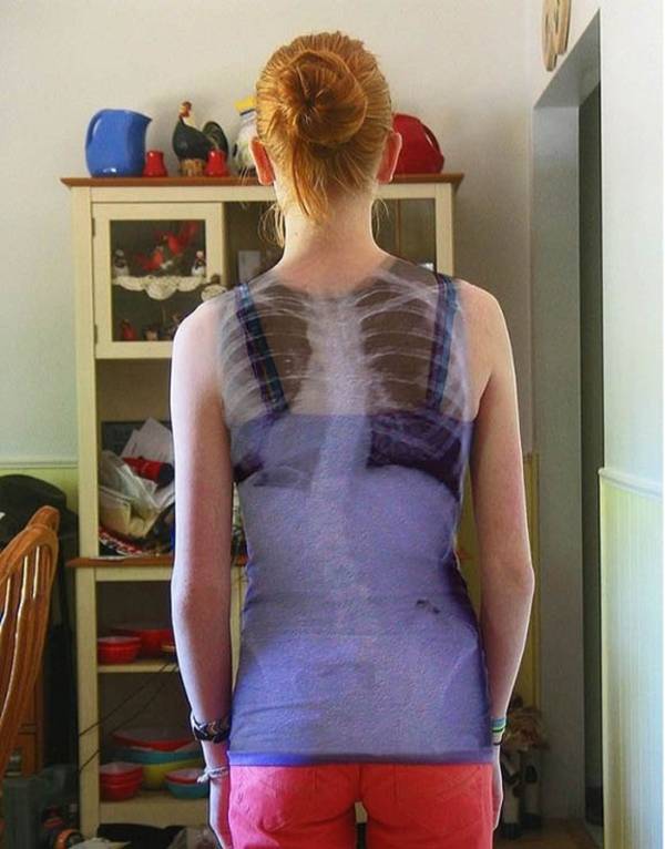 Epic Spinal X-Ray Dress.