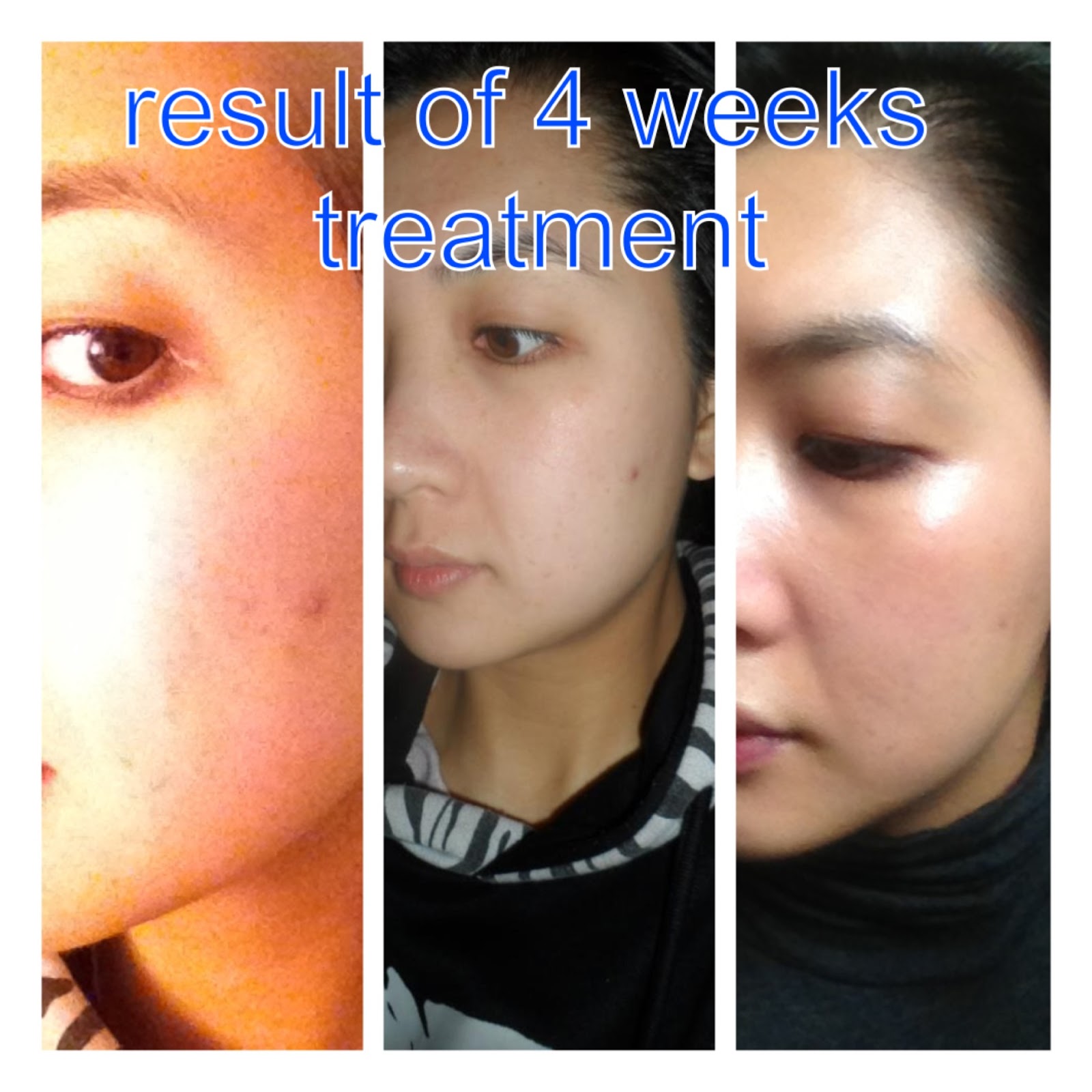 Dream and Love Galvanic Spa from Nu Skin Product Review