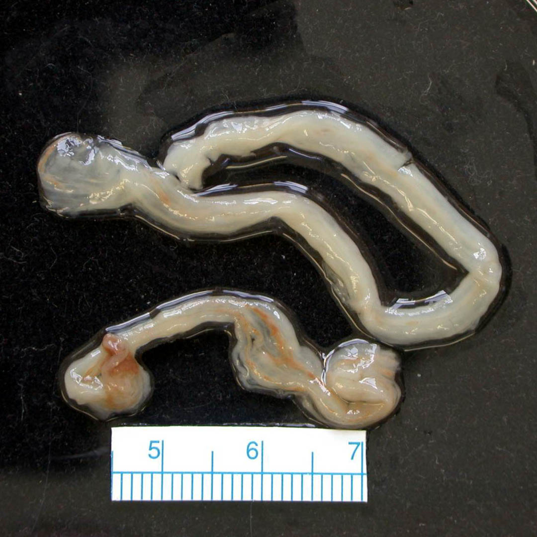 Booger Worm