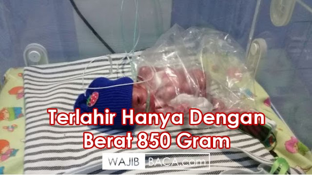 Bayi Mungil Ini Harus Berjuang Keras Untuk Tetap Hidup Ditengah Orang Tuanya yang Kesusahan Bayi Mungil Ini Harus Berjuang Keras Untuk Tetap Hidup Ditengah Orang Tuanya yang Kesusahan