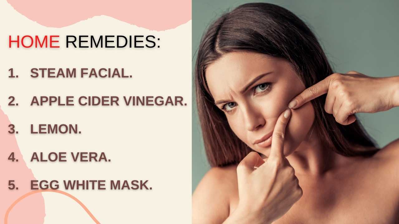 whiteheads-causes-how-to-get-rid-of-whiteheads-naturally-2020