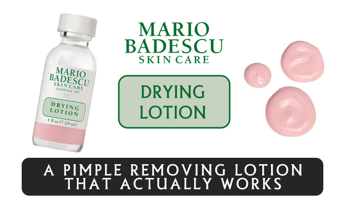 An Acne Spot Treatment Lotion That Actually Works | Mario badescu drying lotion