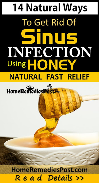 Honey For Sinus Infection, How To Use Honey For Sinus Infection, Sinus Pain, how to get rid of sinus infection, home remedies for sinus infection, sinus infection relief overnight fast, how to cure sinus infection, how to treat sinus infection, home remedies for sinus pain, sinus infection treatment, cure sinus infection, sinus infection home remedies, remedy for sinus infection, treatment for sinus infection, best sinus infection treatment, sinus infection remedy,