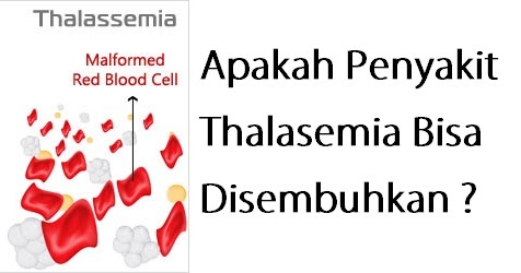 Penyakit thalasemia maksud Mengenal Penyakit