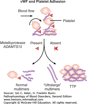 Thrombotic thrombocytopenic purpura, what to know?