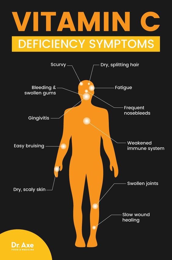 Vitamin C Deficiency Symptoms