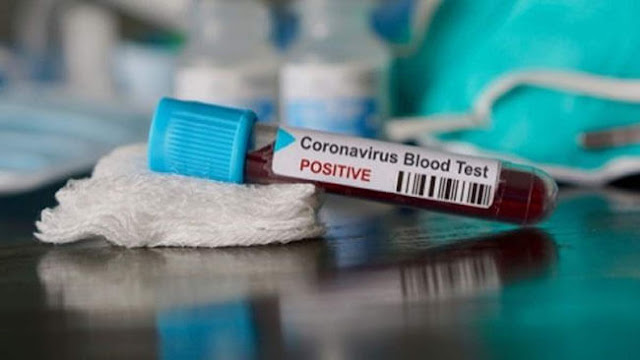 Mencegah Penyebaran Virus Corona Atau Covid-19 Bang Arshad Mencegah Penyebaran Virus Corona Atau Covid-19 Bang Arshad
