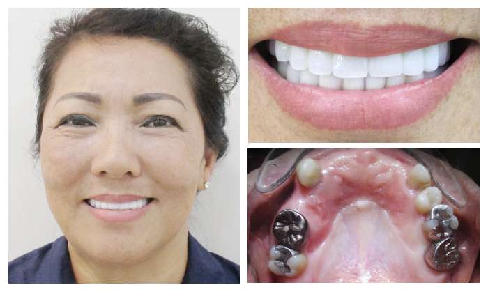 nha-khoa-quan-hoan-kiem-navii-dental-care%2B%25286%2529.jpg