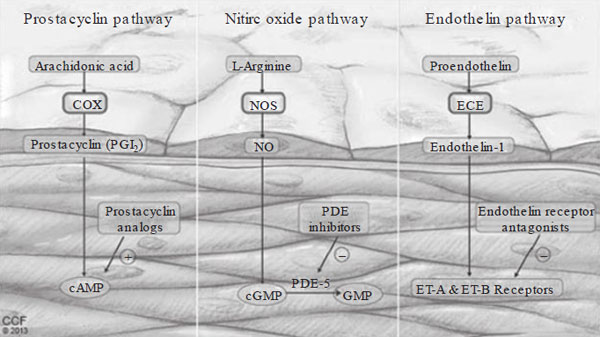 pulmonary arterial hypertension