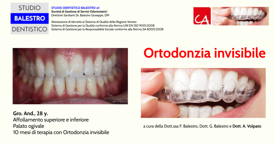 Catene Elastiche Ortodontiche Fasce Elastiche Ortodontiche ORMCO Zoo Park - Catene Elastiche E Cravatte Per Denti, Confezione Da 3,5 Once Elastici Per Apparecchio - Foto 4