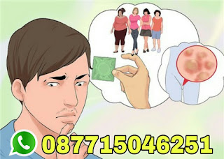 5+ HARGA OBAT KUTIL KELAMIN DE NATURE INDONESIA