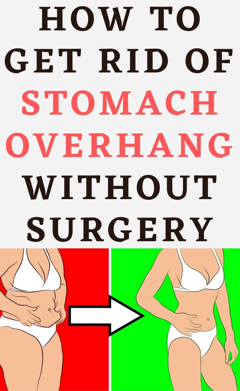 10-tips-on-how-to-get-rid-of-stomach-overhang-without-surgery-hello