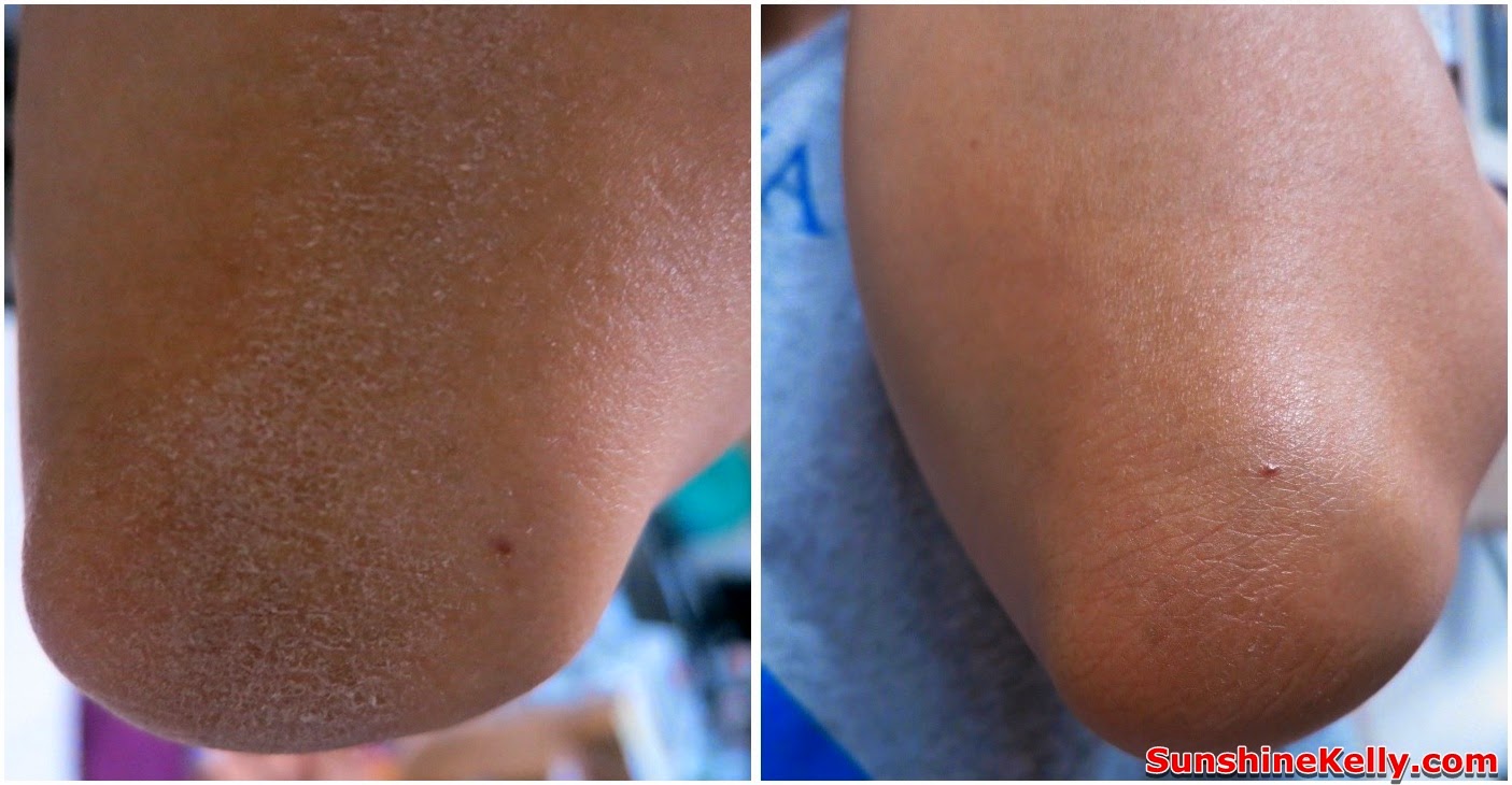 Vitamin C Supplements Before And After / Before and after using